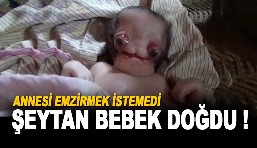 'Şeytan bebek doğdu' Köylüler hastaneye akın etti