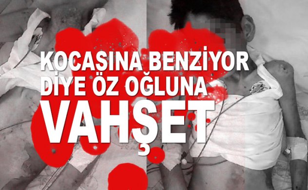 Kocasına benzediği için öz oğluna işkence yaptı, öldü sanıp ...