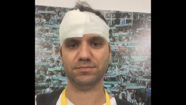 Bursaspor-Galatasaray maçında taraftar terörü: 3 gazeteci yaralandı