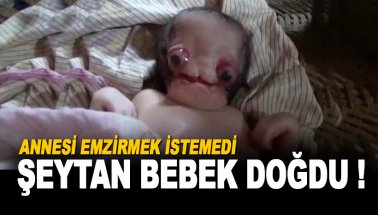 'Şeytan bebek doğdu' Köylüler hastaneye akın etti