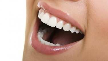 Lingual ortodonti sayesinde diş teli takma kabusu sona eriyor
