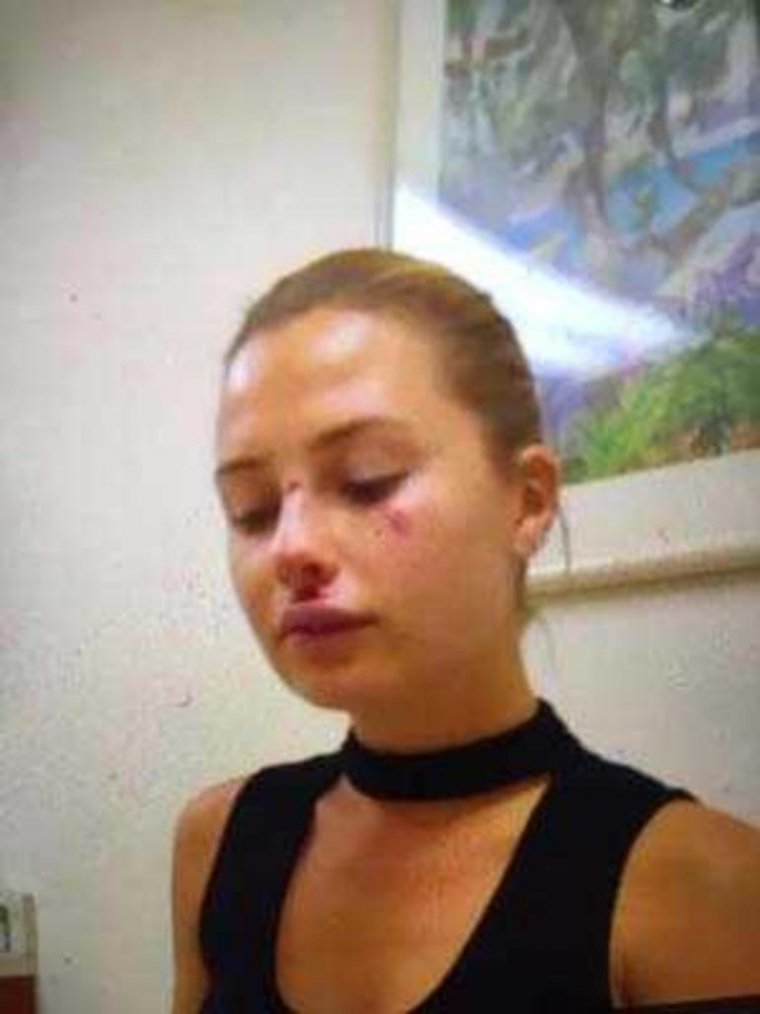 Serdar Ortaç’ın eşi Chloe Miami'de kaza geçirdi