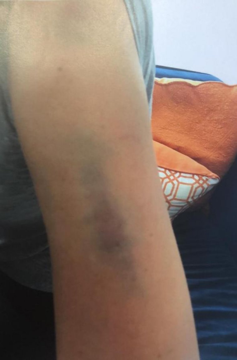 Sıla: Ahmet Kural kafamı duvarlara vurup, yerlerde sürükledi