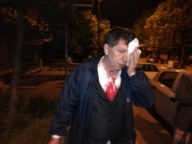 Son dakika: Gazeteci ve Yazar Yavuz Selim Demirağ'a saldırı