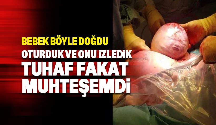 Amniyotik kesede doğan bebek: Tuhaf fakat muhteşemdi