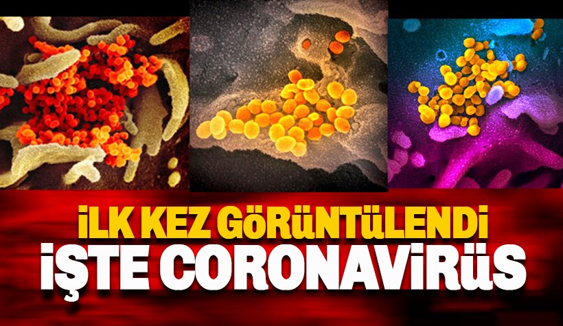 Koronavirüs ilk kez fotoğraflandı