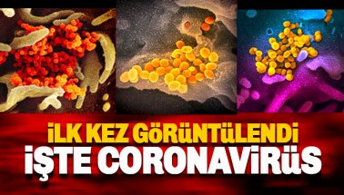 Koronavirüs ilk kez fotoğraflandı