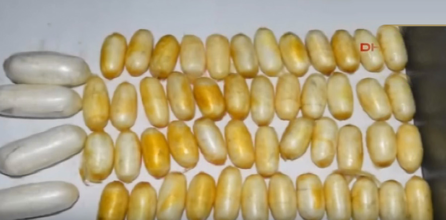 Midesinden prezervatif çıkarılan kadın